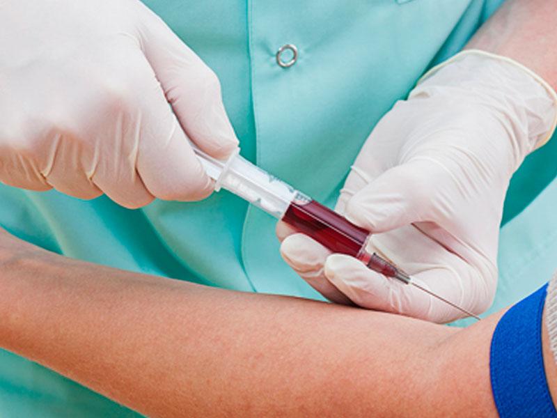 Exames de sangue nem sempre exigem jejum: saiba quando é de fato recomendado