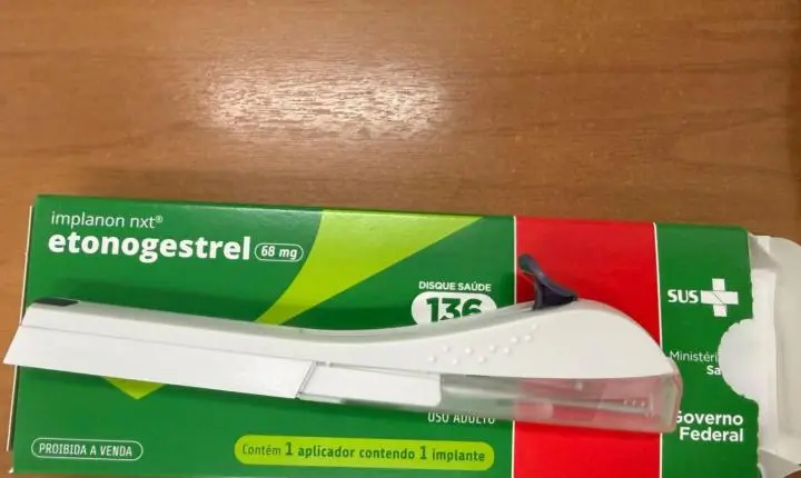 Implante contraceptivo Implanon é oferecido gratuitamente pelo SUS em São Bento do  Sul